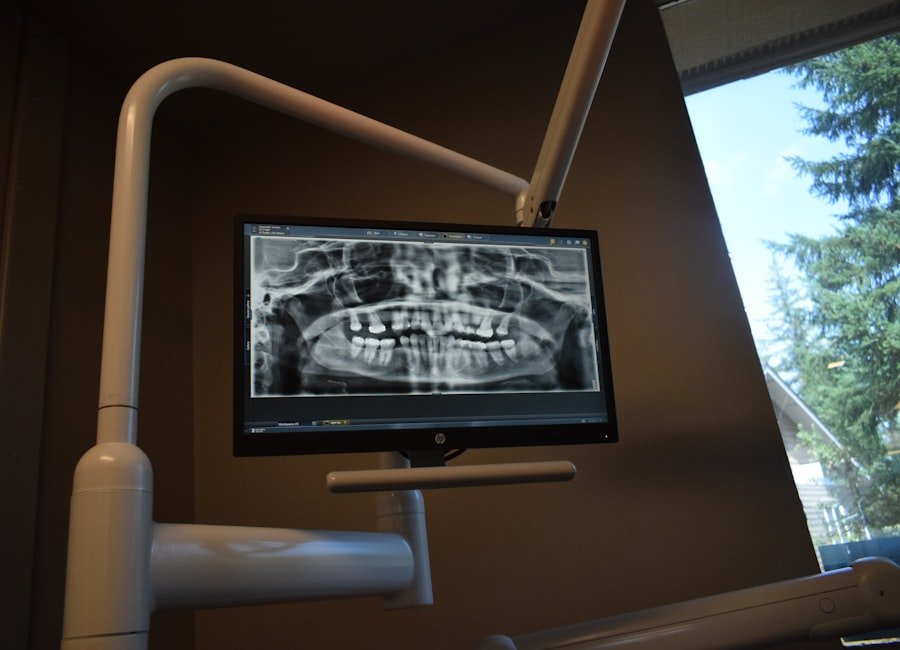 Radiografía panorámica dental