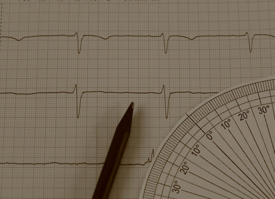 Electrocardiograma